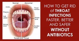 Throat infection home remedy for adults
