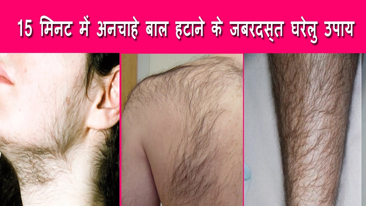 Permanently remove unwanted facial hair