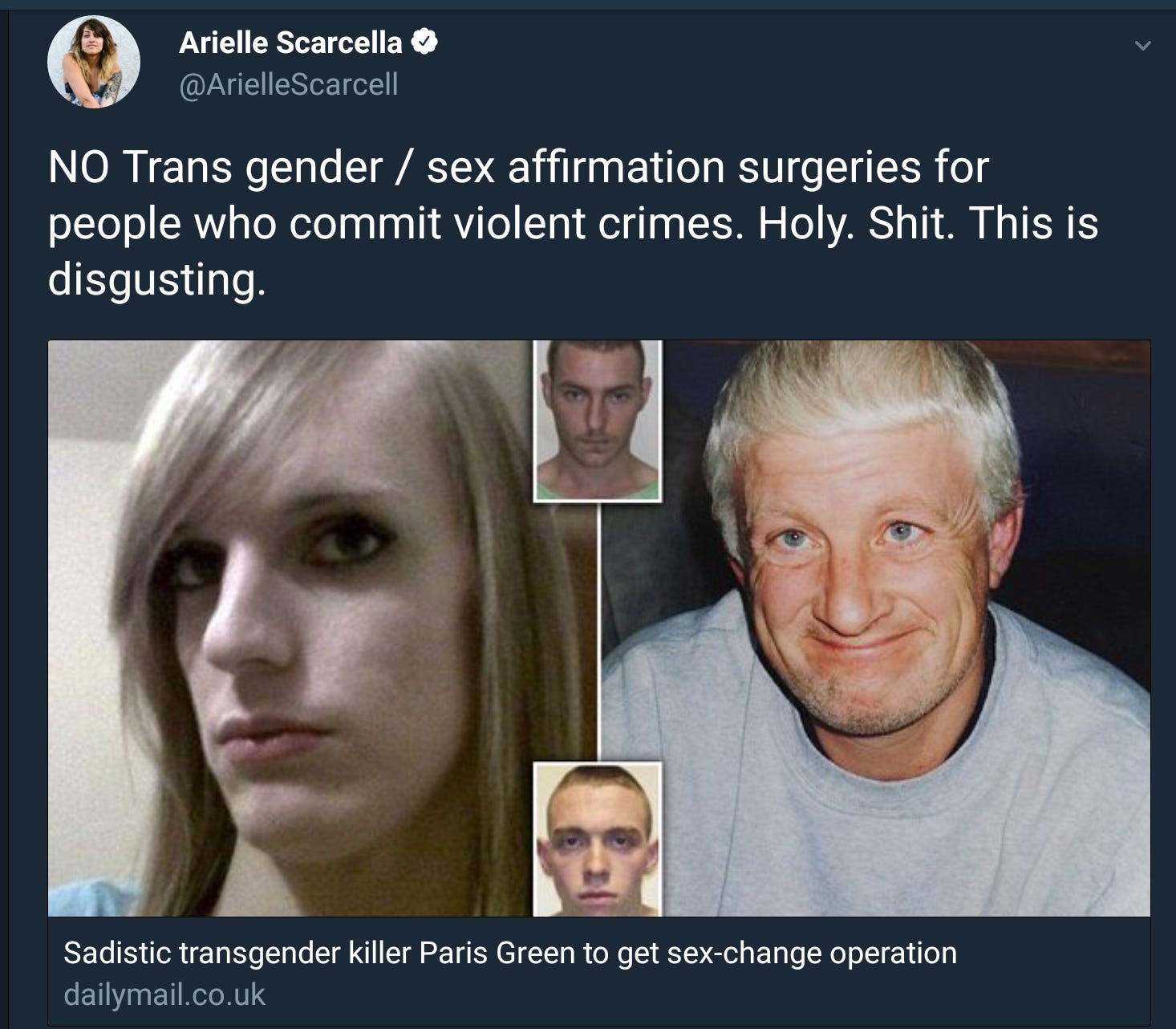 Persons having sex change operations
